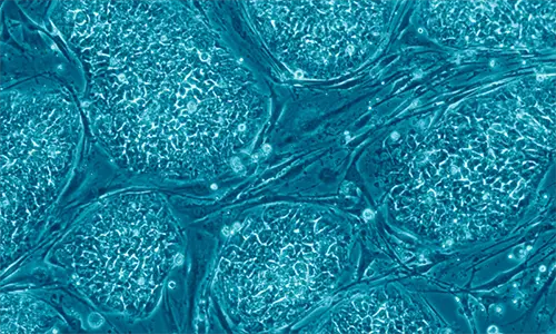 800px-Human_embryonic_stem_cells_only_A